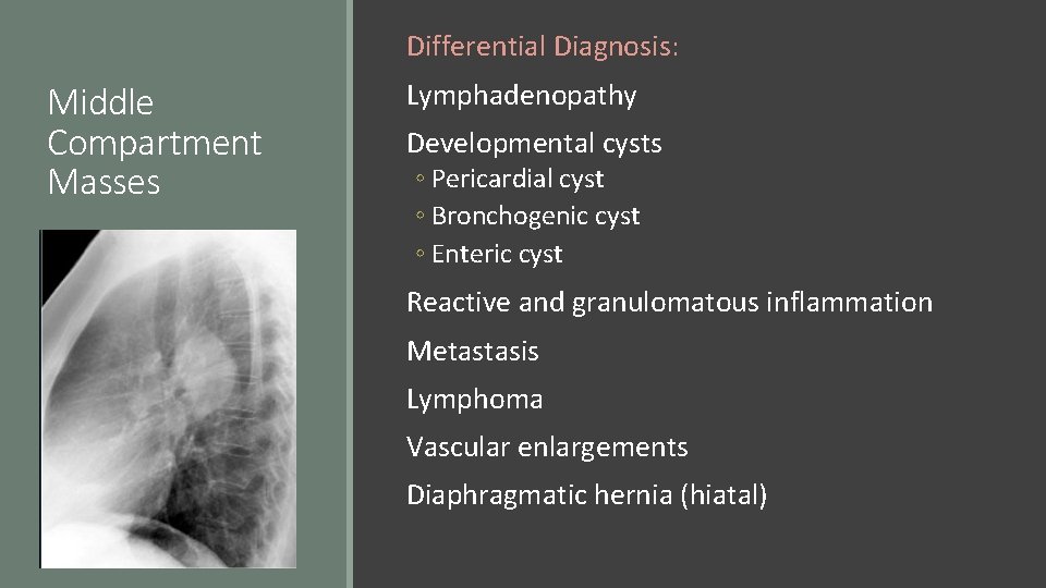 Differential Diagnosis: Middle Compartment Masses Lymphadenopathy Developmental cysts ◦ Pericardial cyst ◦ Bronchogenic cyst