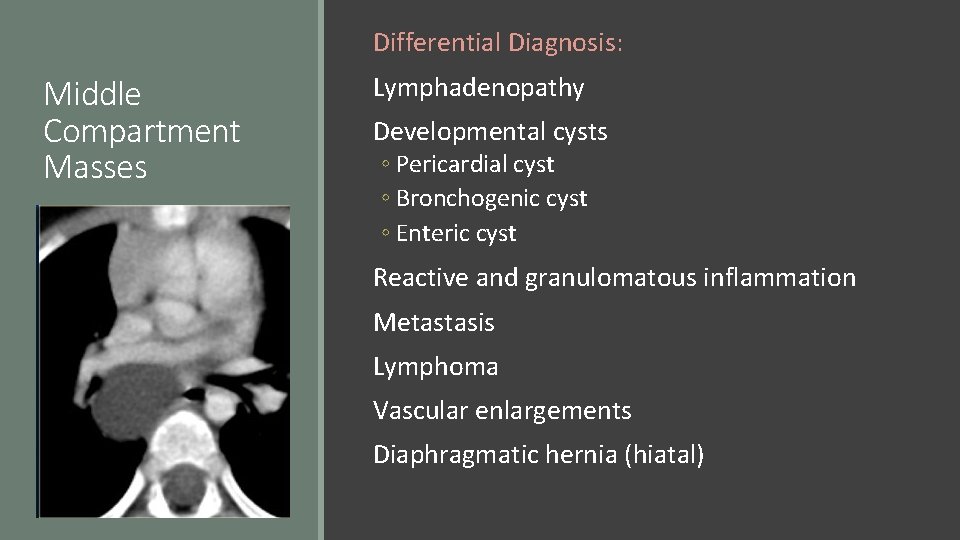 Differential Diagnosis: Middle Compartment Masses Lymphadenopathy Developmental cysts ◦ Pericardial cyst ◦ Bronchogenic cyst