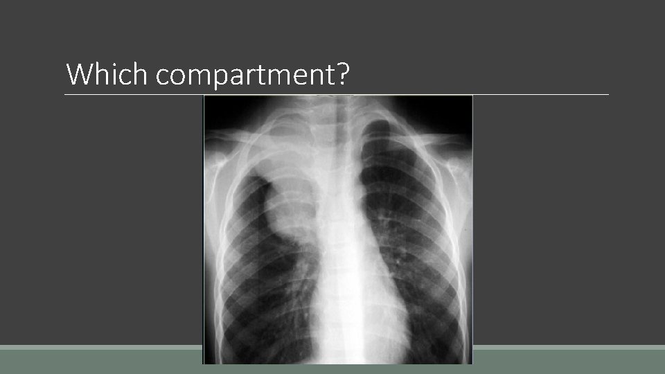 Which compartment? 