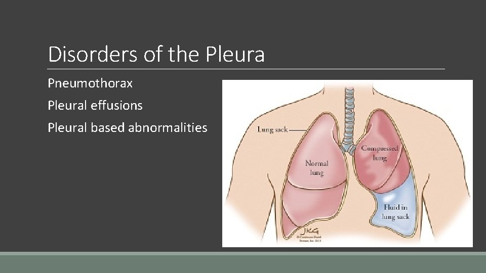 Disorders of the Pleura Pneumothorax Pleural effusions Pleural based abnormalities 