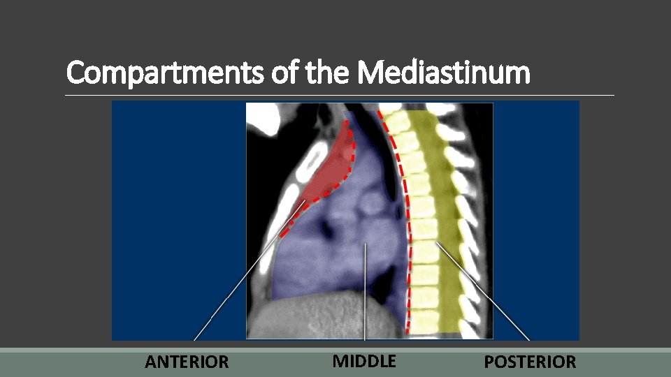 Compartments of the Mediastinum ANTERIOR MIDDLE POSTERIOR 