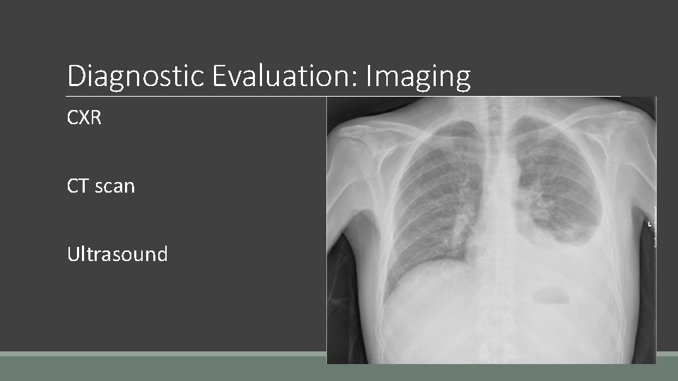 Diagnostic Evaluation: Imaging CXR CT scan Ultrasound 