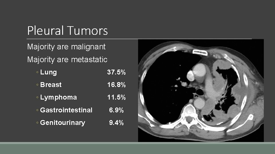 Pleural Tumors Majority are malignant Majority are metastatic ◦ Lung 37. 5% ◦ Breast