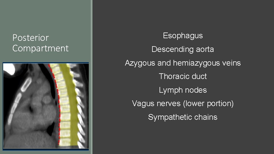 Posterior Compartment Esophagus Descending aorta Azygous and hemiazygous veins Thoracic duct Lymph nodes Vagus
