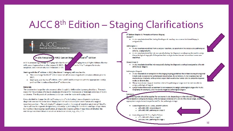 AJCC 8 th Edition – Staging Clarifications 15 