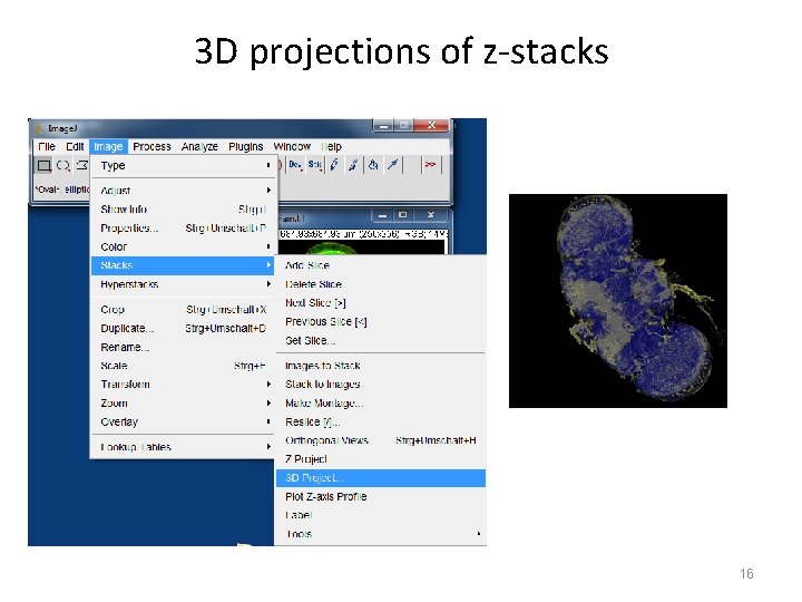 3 D projections of z-stacks 16 