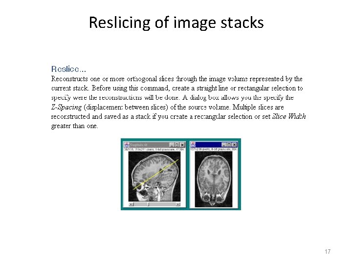 Reslicing of image stacks 17 