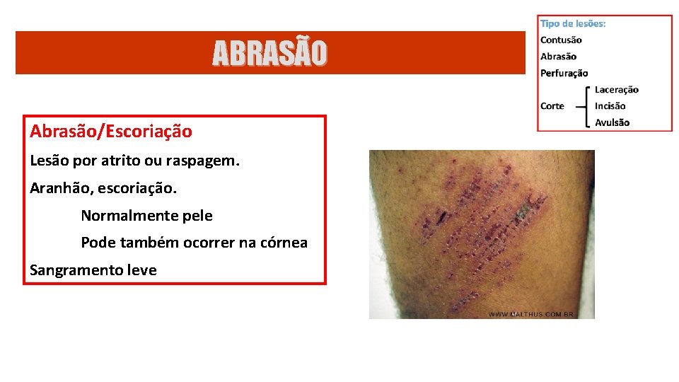 Leses de Partes Moles Profa Dra Cludia Forjaz