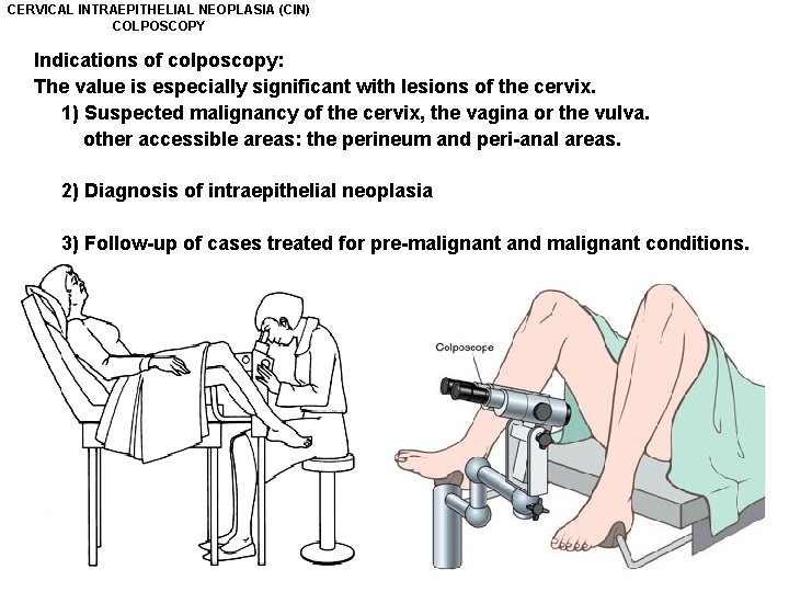 CERVICAL INTRAEPITHELIAL NEOPLASIA (CIN) COLPOSCOPY Indications of colposcopy: The value is especially significant with