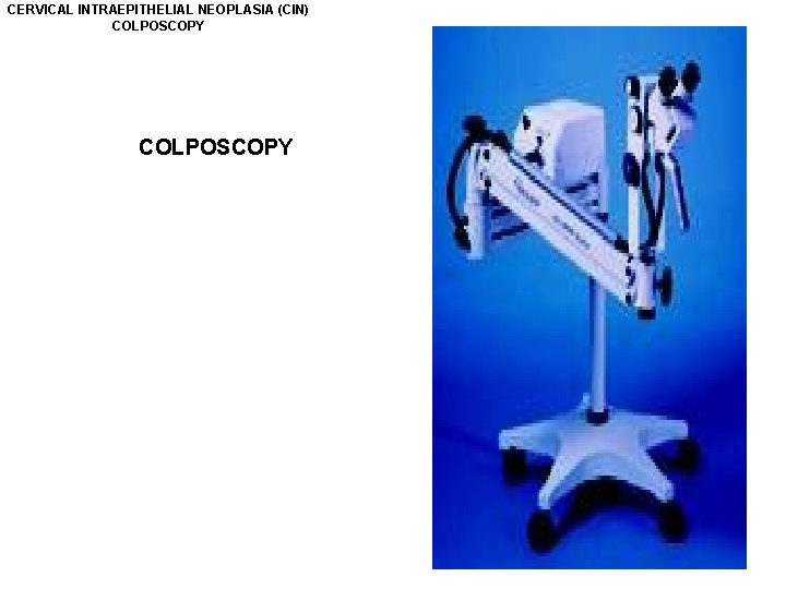 CERVICAL INTRAEPITHELIAL NEOPLASIA (CIN) COLPOSCOPY 