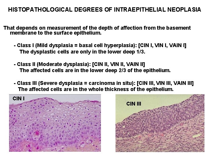HISTOPATHOLOGICAL DEGREES OF INTRAEPITHELIAL NEOPLASIA That depends on measurement of the depth of affection