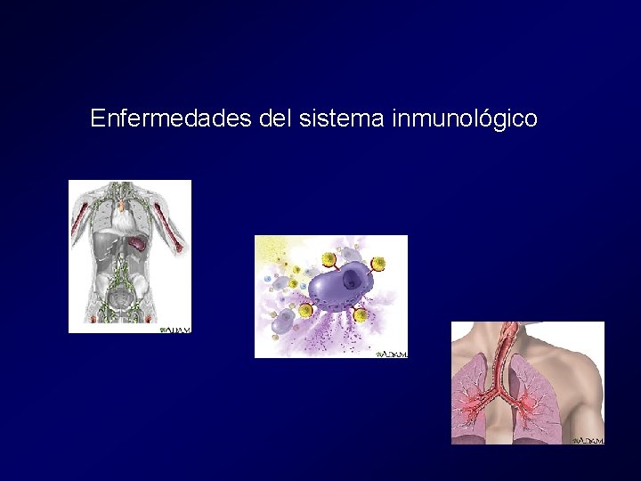 Enfermedades del sistema inmunológico Enfermedades del sistema inmunológico
