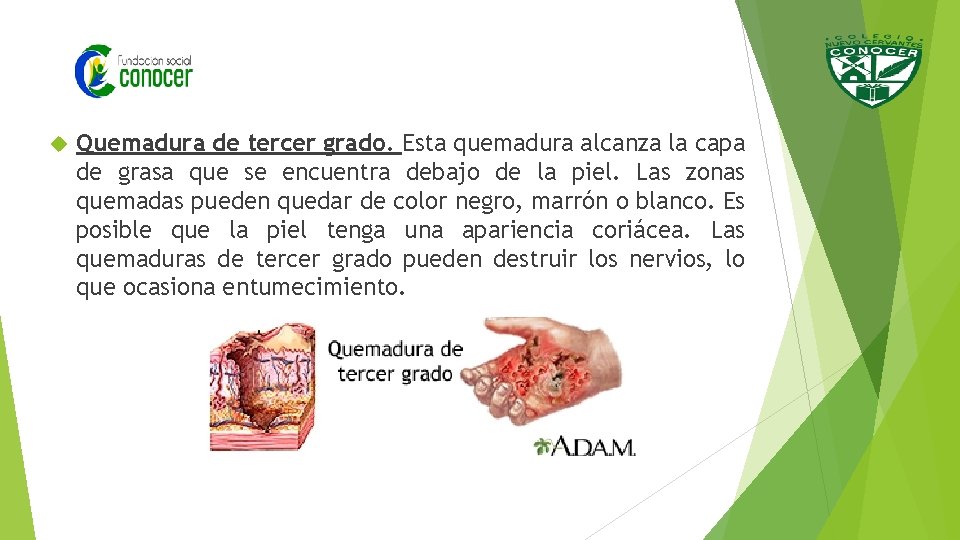  Quemadura de tercer grado. Esta quemadura alcanza la capa de grasa que se