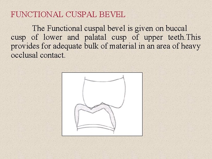 FUNCTIONAL CUSPAL BEVEL The Functional cuspal bevel is given on buccal cusp of lower