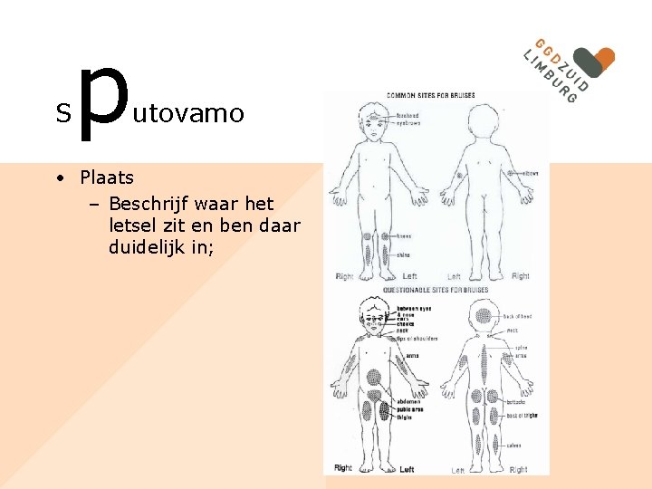 S p utovamo • Plaats – Beschrijf waar het letsel zit en ben daar