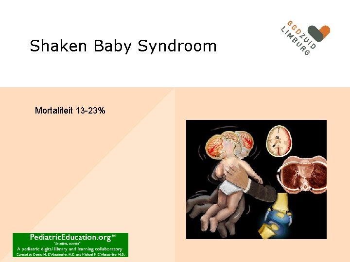 Shaken Baby Syndroom Mortaliteit 13 -23% 