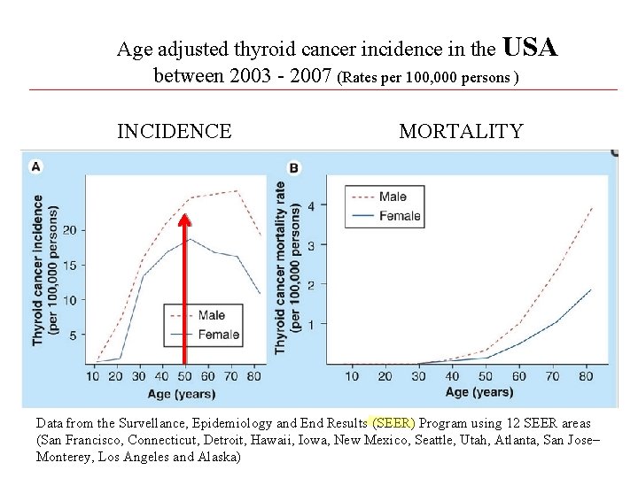 Age adjusted thyroid cancer incidence in the USA between 2003 - 2007 (Rates per