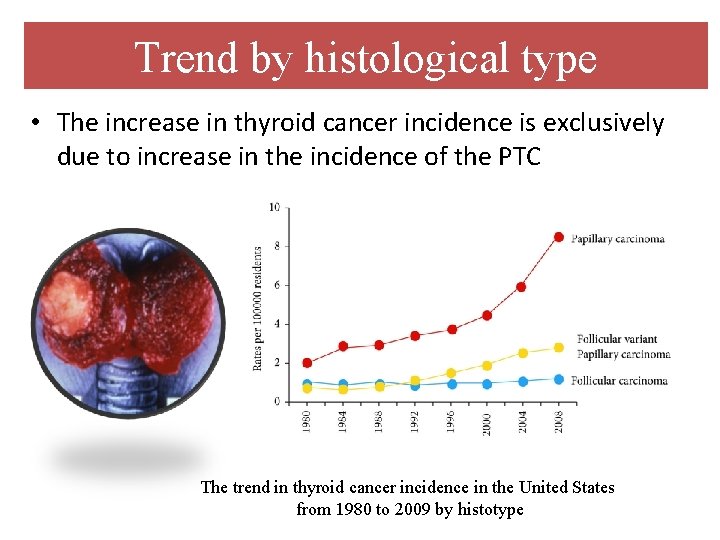 Trend by histological type • The increase in thyroid cancer incidence is exclusively due
