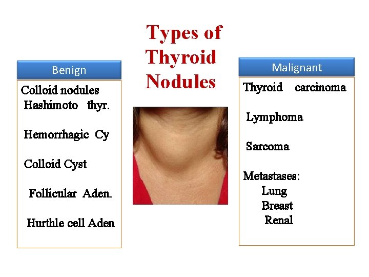 Benign Colloid nodules Hashimoto thyr. Hemorrhagic Cy Colloid Cyst Follicular Aden. Hurthle cell Aden