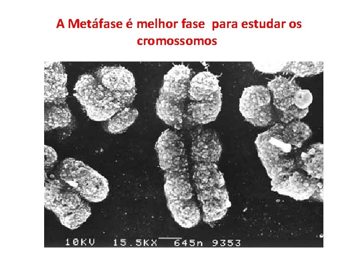 A Metáfase é melhor fase para estudar os cromossomos. 