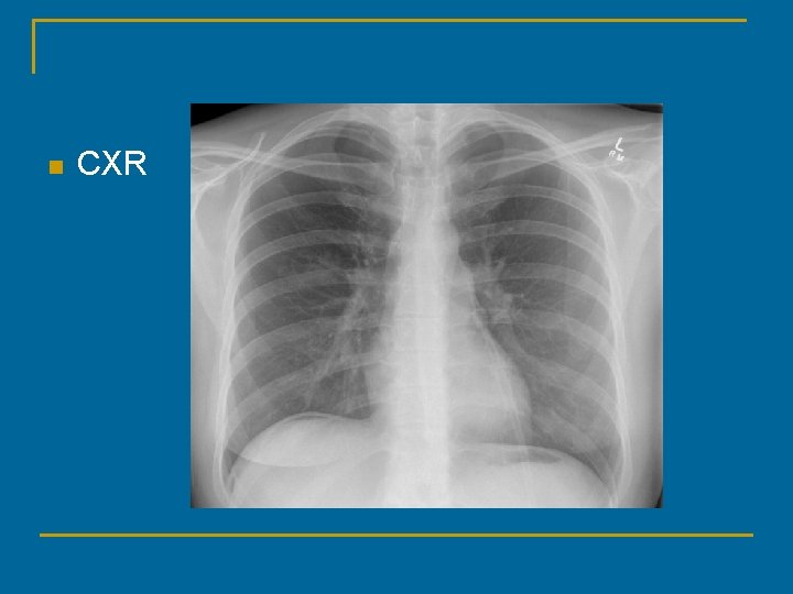 n CXR 