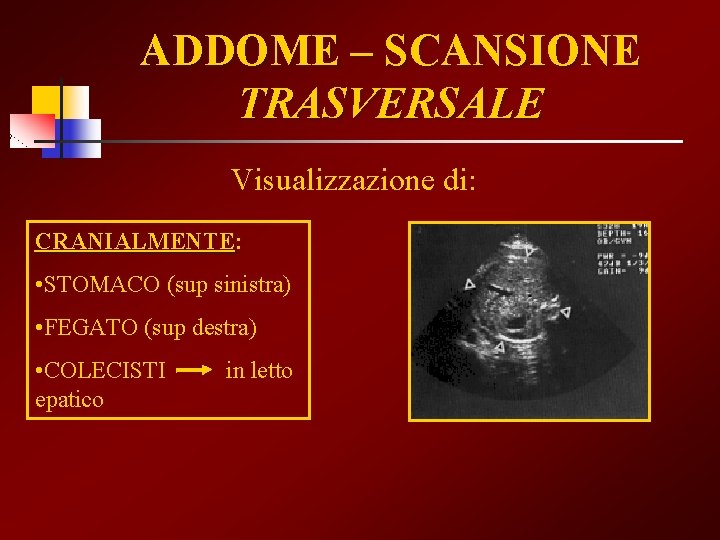 ADDOME – SCANSIONE TRASVERSALE Visualizzazione di: CRANIALMENTE • STOMACO (sup sinistra) • FEGATO (sup