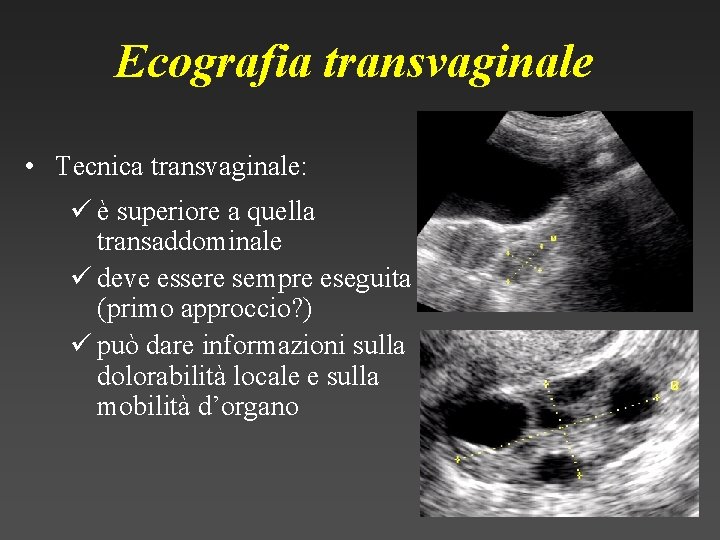 Ecografia transvaginale • Tecnica transvaginale: ü è superiore a quella transaddominale ü deve essere