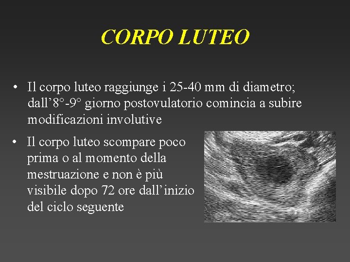 CORPO LUTEO • Il corpo luteo raggiunge i 25 -40 mm di diametro; dall’