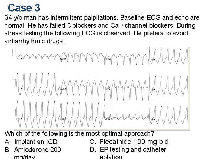 Case 3 34 y/o man has intermittent palpitations. Baseline ECG and echo are normal.