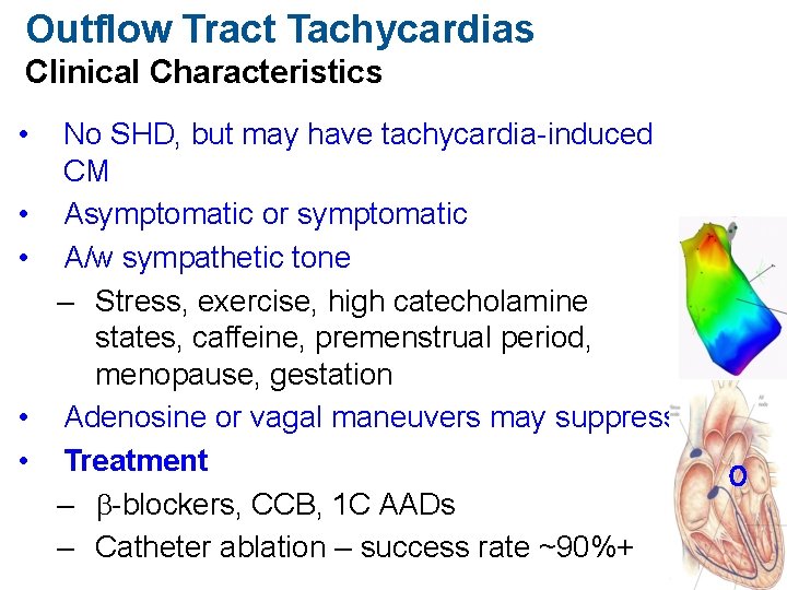 Outflow Tract Tachycardias Clinical Characteristics • • • No SHD, but may have tachycardia-induced