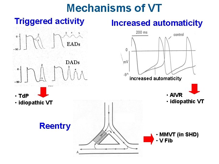 Mechanisms of VT Triggered activity Increased automaticity EADs DADs increased automaticity • Td. P
