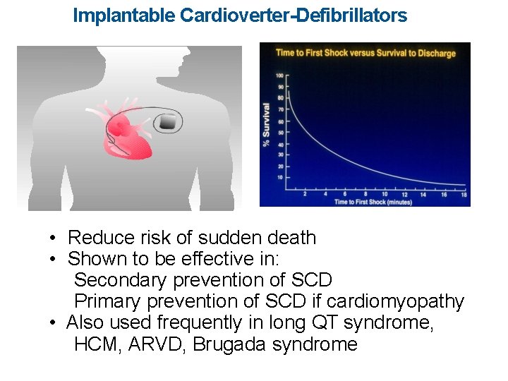 Implantable Cardioverter-Defibrillators • Reduce risk of sudden death • Shown to be effective in: