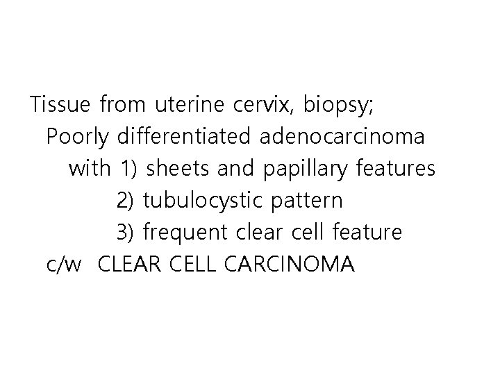 Tissue from uterine cervix, biopsy; Poorly differentiated adenocarcinoma with 1) sheets and papillary features