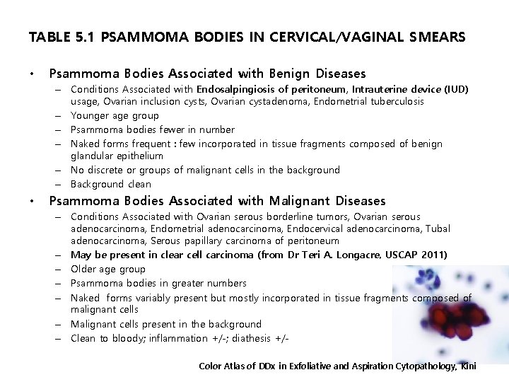 TABLE 5. 1 PSAMMOMA BODIES IN CERVICAL/VAGINAL SMEARS • Psammoma Bodies Associated with Benign