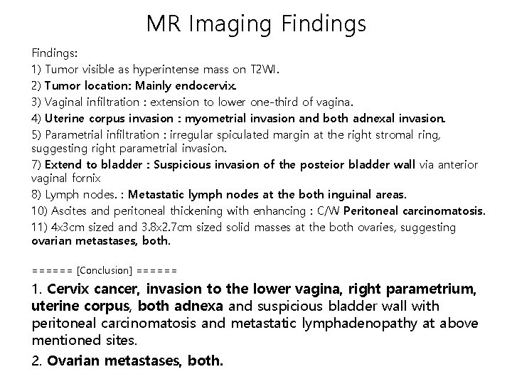MR Imaging Findings: 1) Tumor visible as hyperintense mass on T 2 WI. 2)