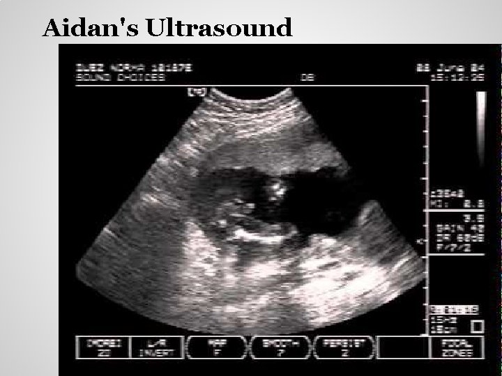 Aidan's Ultrasound 