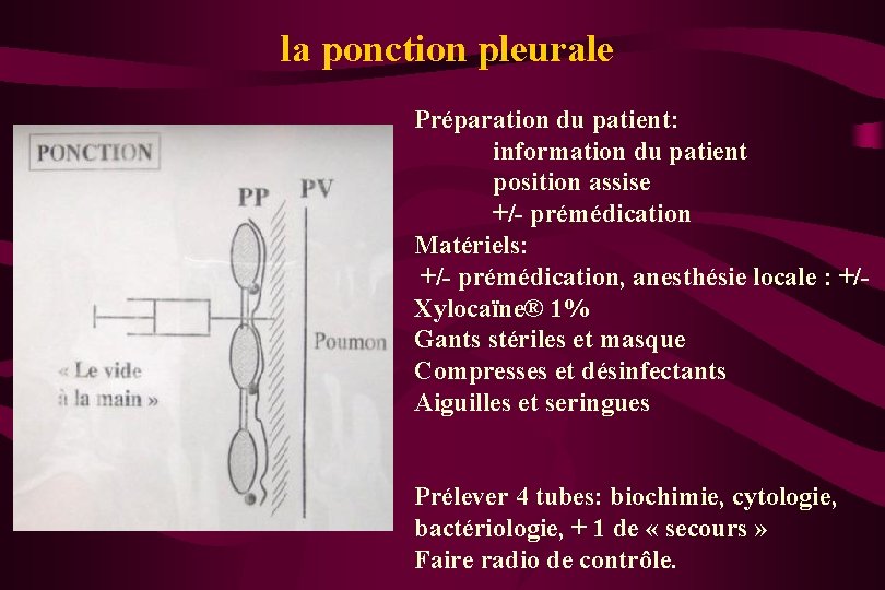 la ponction pleurale Préparation du patient: information du patient position assise +/- prémédication Matériels:
