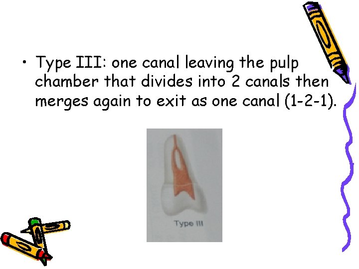  • Type III: one canal leaving the pulp chamber that divides into 2
