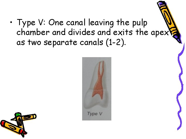  • Type V: One canal leaving the pulp chamber and divides and exits