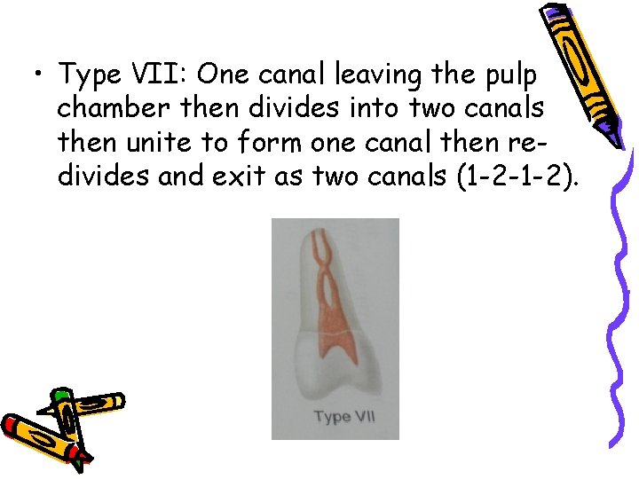 • Type VII: One canal leaving the pulp chamber then divides into two