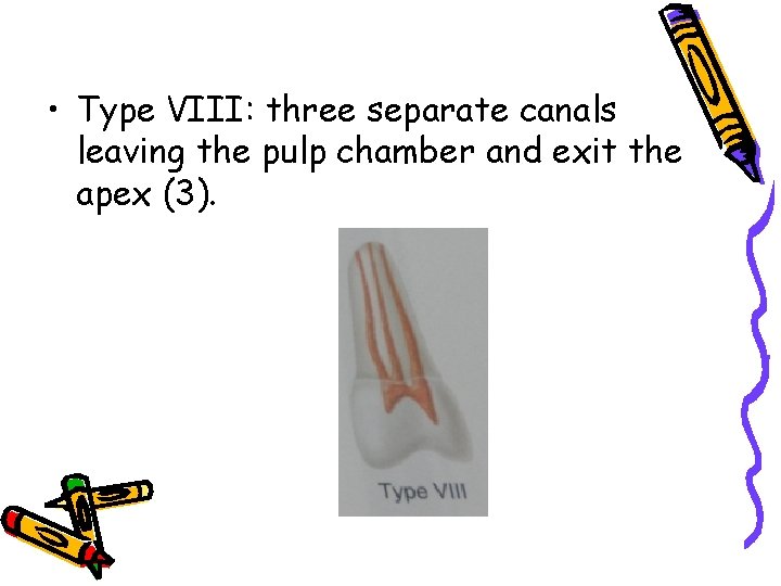  • Type VIII: three separate canals leaving the pulp chamber and exit the