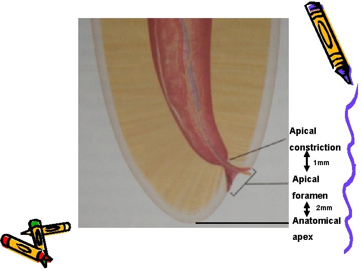 Apical constriction 1 mm Apical foramen 2 mm Anatomical apex 