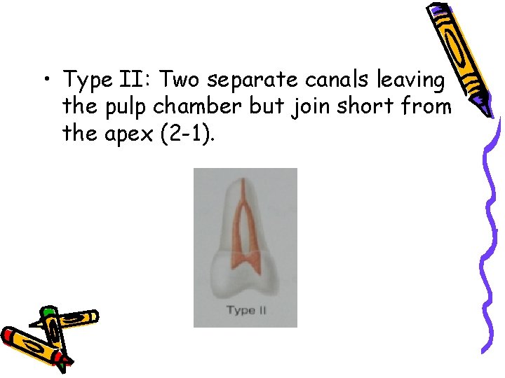  • Type II: Two separate canals leaving the pulp chamber but join short