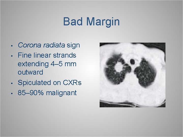 Bad Margin • • Corona radiata sign Fine linear strands extending 4– 5 mm