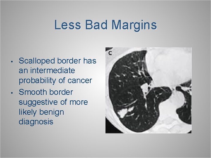 Less Bad Margins • • Scalloped border has an intermediate probability of cancer Smooth