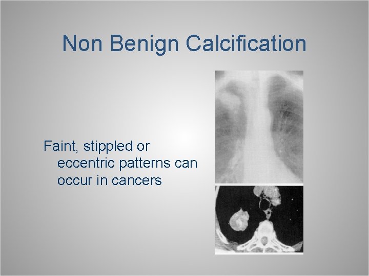 Non Benign Calcification Faint, stippled or eccentric patterns can occur in cancers 