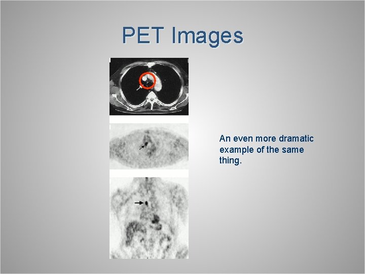 PET Images An even more dramatic example of the same thing. 
