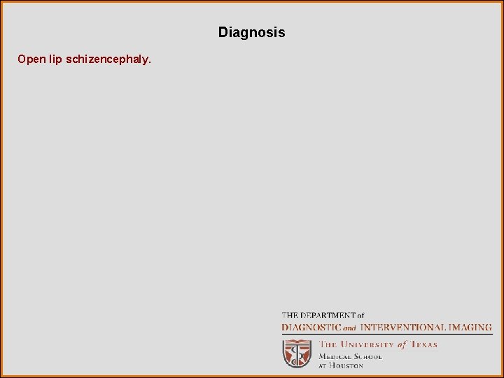 Diagnosis Open lip schizencephaly. 