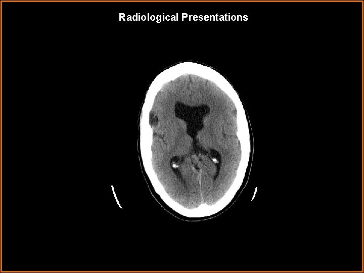 Radiological Presentations 