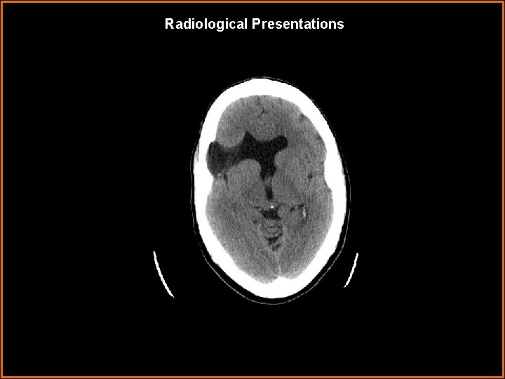 Radiological Presentations 
